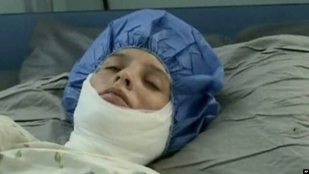 Recently, some Afghan women set themselves on fire to escape domestic violence