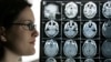 Peneliti AS Buat Pemindai Otak Murah