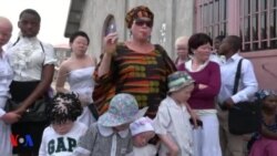 Siku ya Wa-Albino Duniani yasherehekewa Goma DRC