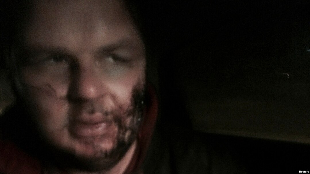 Dmytro Bulatov, one of the leaders of anti-government protest motorcades called 'Automaidan', is seen just after being found near Kyiv, January 30, 2014.