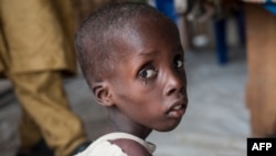 Boy suffering from severe acute malnutrition at a UNICEF nutrition clinic in the Muna informal settlement, which houses nearly 16,000 internally displaced people in the outskirts of Maiduguri, capital of Borno State, northeastern Nigeria, June 30, 2016.