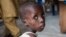 Boy suffering from severe acute malnutrition at a UNICEF nutrition clinic in the Muna informal settlement, which houses nearly 16,000 internally displaced people in the outskirts of Maiduguri, capital of Borno State, northeastern Nigeria, June 30, 2016.