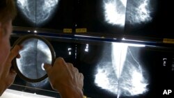 FILE - A radiologist uses a magnifying glass to check mammograms for breast cancer in Los Angeles, California, May 6, 2010.