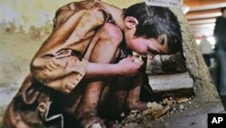 A photo showing a North Korean child suffering from famine. (File)