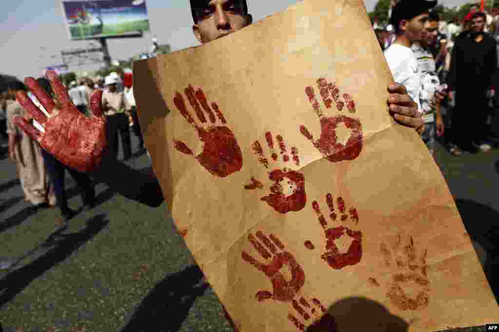 A supporter of the Muslim Brotherhood and ousted Egyptian president Mohamed Morsi shows his blood-stained hand while holding a placard bearing handprints made with the blood of victims who were shot during a gun battle outside the Cairo headquarters of the Republican Guard.