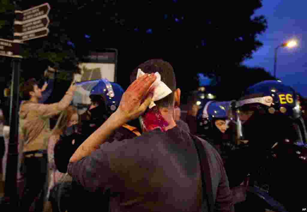 A photographer holds his head after he was attacked by protesters in Hackney, east London, Monday, Aug. 8, 2011. Violence and looting spread across some of London's most impoverished neighborhoods on Monday, with youths setting fire to shops and vehicles,