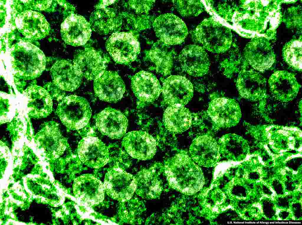  An electron-microscope image of a cluster of SARS-CoV-2 virions. Coronavirus virions use the spikes on their surface as a kind of key that binds with receptors in some human cells. (Courtesy: U.S. National Institute of Allergy and Infectious Diseases)