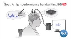 LogOn: Computers and Brains: Sensors Implanted in the Brain Help Paralyzed Man Write