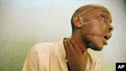 FILE: Nyabimana (first name unknown), 26, shows machete wounds at an International Committee of the Red Cross Hospital in Nyanza, some 35 miles southwest of Kigali, Rwanda, on June 4, 1994. 