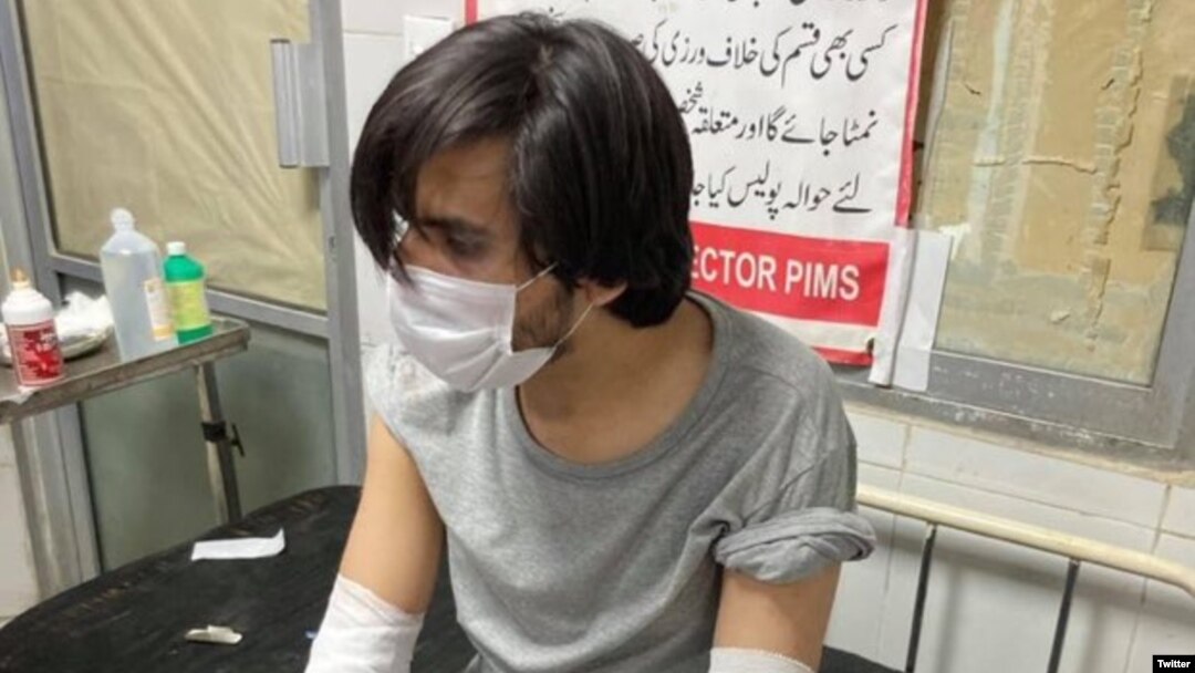 اسد طور نے بتايا کہ ان پر حملہ کرنے والوں نے ان کے ہاتھ پير باندھ کر انہيں بری طرح مارا پيٹا اور پستول کے بٹ مار مار کر ان کی کہنياں لہو لہان کر ديں اور ان کے چيخنے چلانے پر انہيں چھوڑ کر بھاگ گئے۔