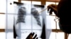 Activist Group Calls on S. Africa to Declare TB a Public Health Emergency