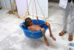 A doctor weighs malnourished boy Hassan Merzam Muhammad at a hospital in Aslam district of Hajjah province, Yemen, July 18, 2020.