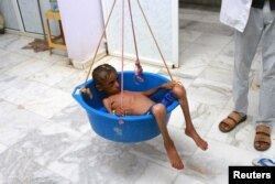 A doctor weighs malnourished boy Hassan Merzam Muhammad at a hospital in Aslam district of Hajjah province, Yemen, July 18, 2020.