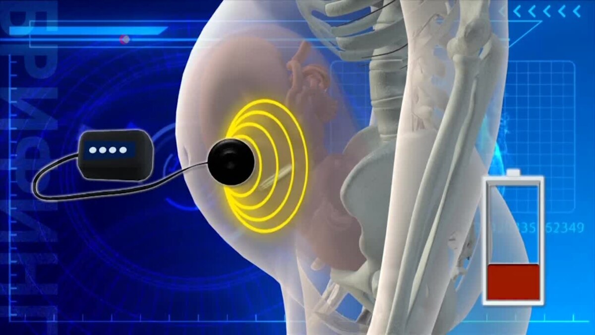 Кардиостимулятор для эмбрионов