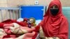 افغانستان کې په خوارځواکۍ اخته ماشومانو شمېر ۴۷سلنه زیات شوی ـ راپور