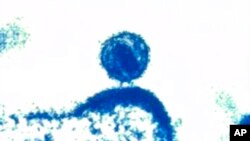 La imagen captada con un microscopio electrónico en 2012, proporcionada por el NIAID (por sus siglas en inglés), muestra un virus de inmunodeficiencia humana, al centro, que brota de una célula inmunitaria a la que había infectado y dentro de la cual se había replicado.