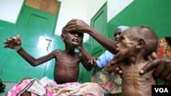 Anak-anak Somalia yang menderita kelaparan akibat bencana kekeringan, dirawat di rumah sakit Mogadishu.