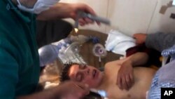 Un jeune homme qui aurait été touché par une attaque chimique, en Syrie, le 4 avril 2017. (Qasioun News Agency, via AP)