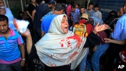 An woman with blood on her clothes screams during clashes between security forces and supporters of Egypt's ousted President Morsi in Ramses Square, in downtown Cairo, Aug. 16, 2013. 