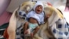 A malnourished child cries at the malnutrition treatment ward of al-Sabeen hospital in Sanaa, Yemen, Oct. 27, 2020. 