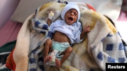 A malnourished child cries at the malnutrition treatment ward of al-Sabeen hospital in Sanaa, Yemen, Oct. 27, 2020. 