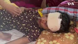 ১৩ বছরের শিশু শ্রমিক হালিমা আগুন থেকে বাঁচতে দোতলা থেকে লাফ দেয়