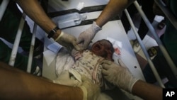 ARCHIVO - Un bebé palestino herido recibe tratamiento en el hospital al-Shifa, luego de los ataques aéreos israelíes en la ciudad de Gaza, en el centro de la Franja de Gaza, el 23 de octubre de 2023.