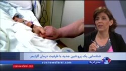 شناسایی پروتئینی در دانشگاه فلوریدا که میتواند به درمان آلزایمر کمک کند