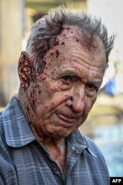 An injured man stands by a vehicle of an emergency unit to receive medical assistance after bombings on the eastern Ukraine town of Chuguiv on Feb. 24, 2022.