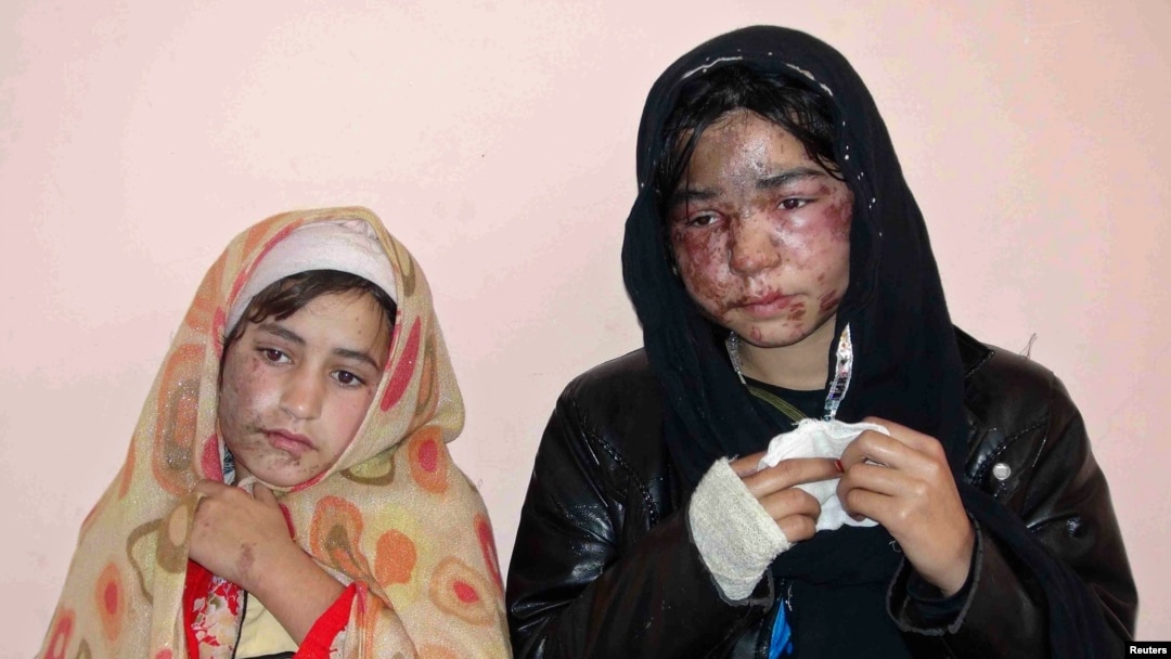 Para korban serangan air keras di Kunduz, Pakistan, yang disebabkan karena penolakan orangtua mereka untuk menikahkan anaknya pada tuan tanah. (Foto: Dok)