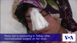 Afghan Woman Undergoes Surgery After Husband Cuts Off Her Nose