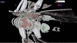 Escaneos microtomográficos