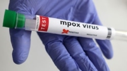 Foto illustrasi yang menunjukkan tabung tes yang dilabeli "positif virus mpox". (Foto: Reuters/Dado Ruvic)