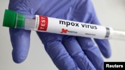 FILE - A test tube labeled "mpox virus positive" is held in this illustration taken Aug. 20, 2024. 