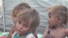 UN: 14 Million Yemenis in Danger as Famine Looms