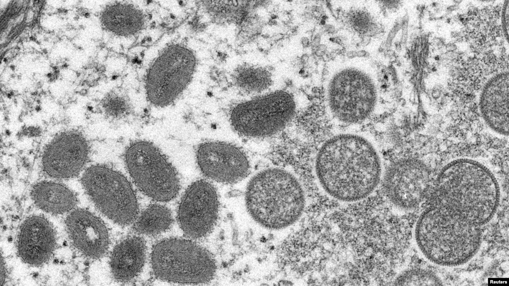 美国疾病防控中心（CDC）发布的在显微镜下看到的猴痘病毒。-路透社照片(photo:VOA)