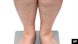 美国肥胖率上升？