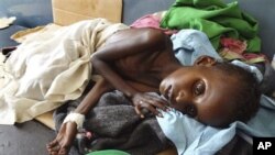 A malnourished child from southern Somalia lies in Banadir hospital in Mogadishu, Somalia ( Aug. file photo)