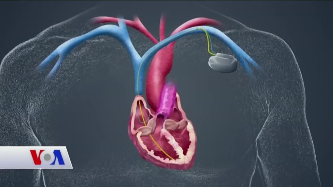 kalp pilleri elektrosokla yasatiyor
