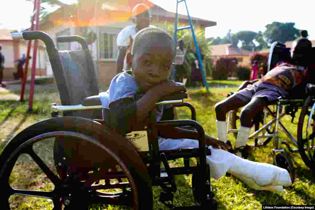 Young boy in wheelchair, legs in plaster.