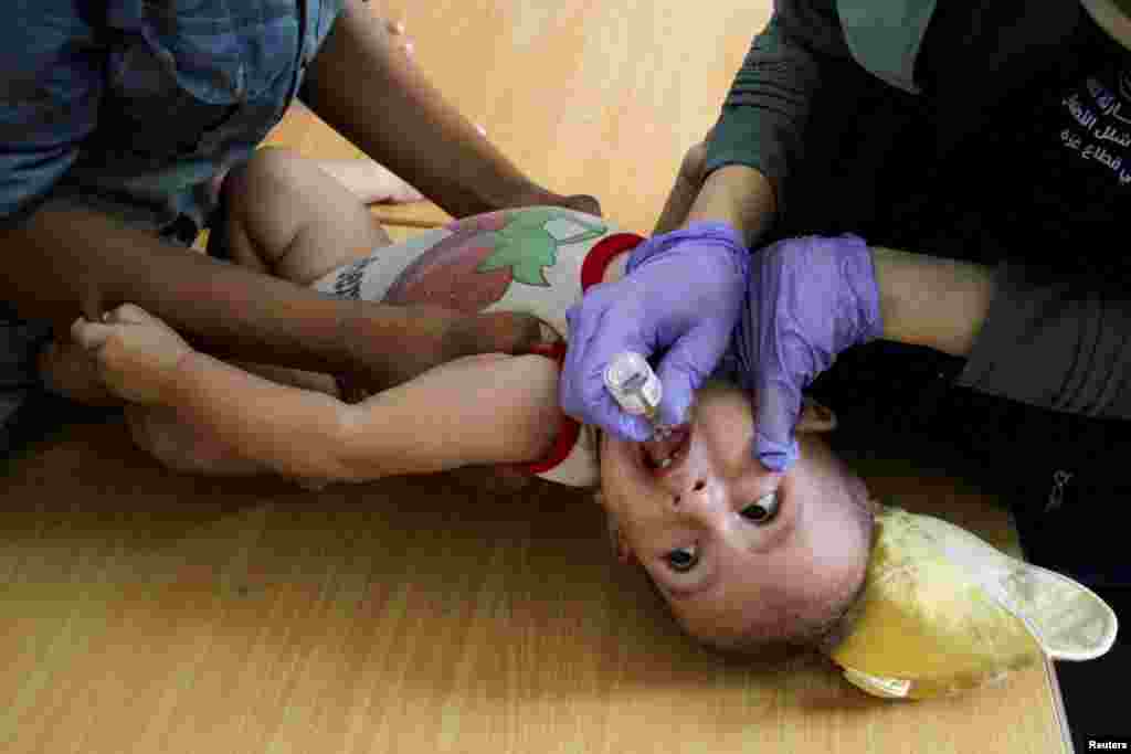 Seorang balita Palestina divaksinasi polio, di tengah konflik Israel-Hamas, di Jabalia di Jalur Gaza utara. (Reuters)&nbsp;