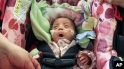 Prematurely born Melinda Star Guido discharged from Los Angeles County-USC Medical Center, Friday, Jan. 20, 2012.