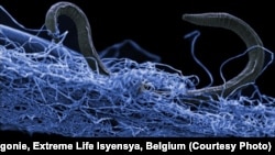 This photo shows a nematode (eukaryote) in a biofilm of microorganisms, an unidentified nematode (Poikilolaimus sp.) from Kopanang gold mine in South Africa,which lives 1.4km below the surface. 