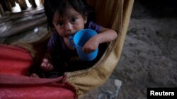 Yesmin Anayeli, una niña de 22 meses diagnosticada con desnutrición severa, sostiene una taza después de beber Incaparina, un alimento vegetal proteico entregado por el gobierno, en su casa, en La Ceiba, Guatemala, el 9 de octubre de 2020. [Foto: Reuters]