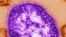 FILE - An undated electron microscope image of a measles virus particle.