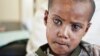 Ethiopians in Mekelle Find Hope at Eye Center