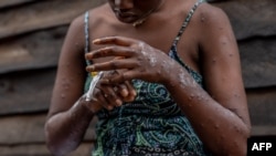 Paciente com Mpox na República Democrática do Congo, 24 agosto 2024