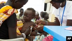 Un enfant souffrant de malnutrition au Soudan du Sud, le 25 juillet 2014.