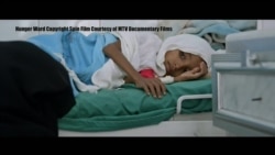 Dokumentar i ri mbi katastrofën humanitare në Jemen