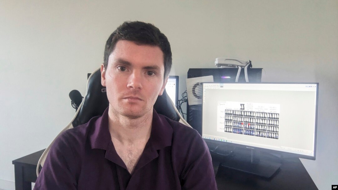 This photo provided by Sholto David shows him at his home in Pontypridd, Wales, Jan. 26, 2024. David is a scientist-sleuth who detects image manipulation in published scientific papers.